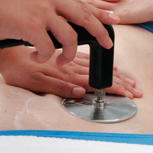 鍼灸治療の写真