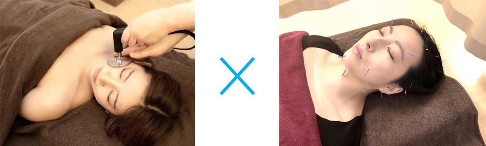 INDIBAフェイシャルの写真