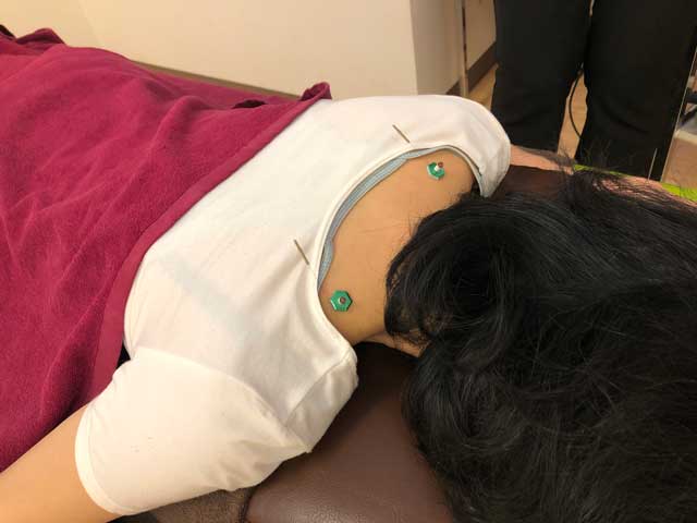 保険治療の写真